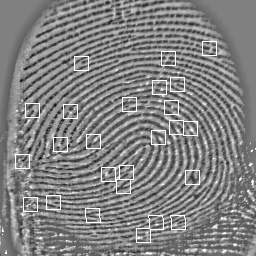 Обнаружение аномальных фрагментов на отпечатках пальцев